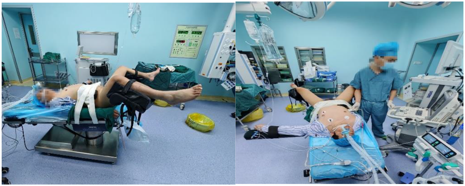 Enhancing lithotripsy efficiency in retrograde intrarenal surgery via a flexible kidney-fixed position: findings from a prospective cohort study