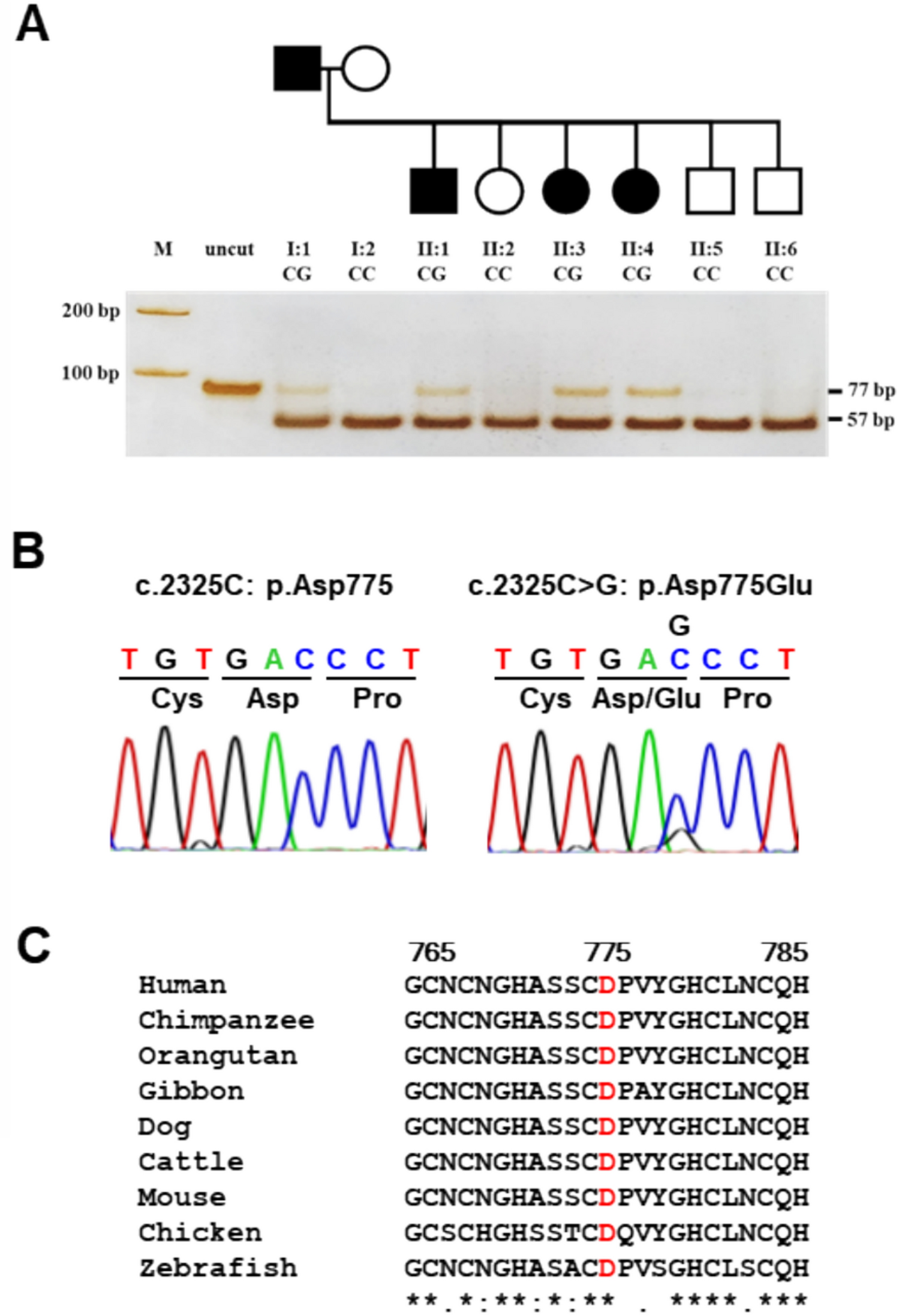 Whole exome sequencing reveals heparan sulfate proteoglycan 2 (HSPG2) as a potential causative gene for kidney stone disease in a Thai family