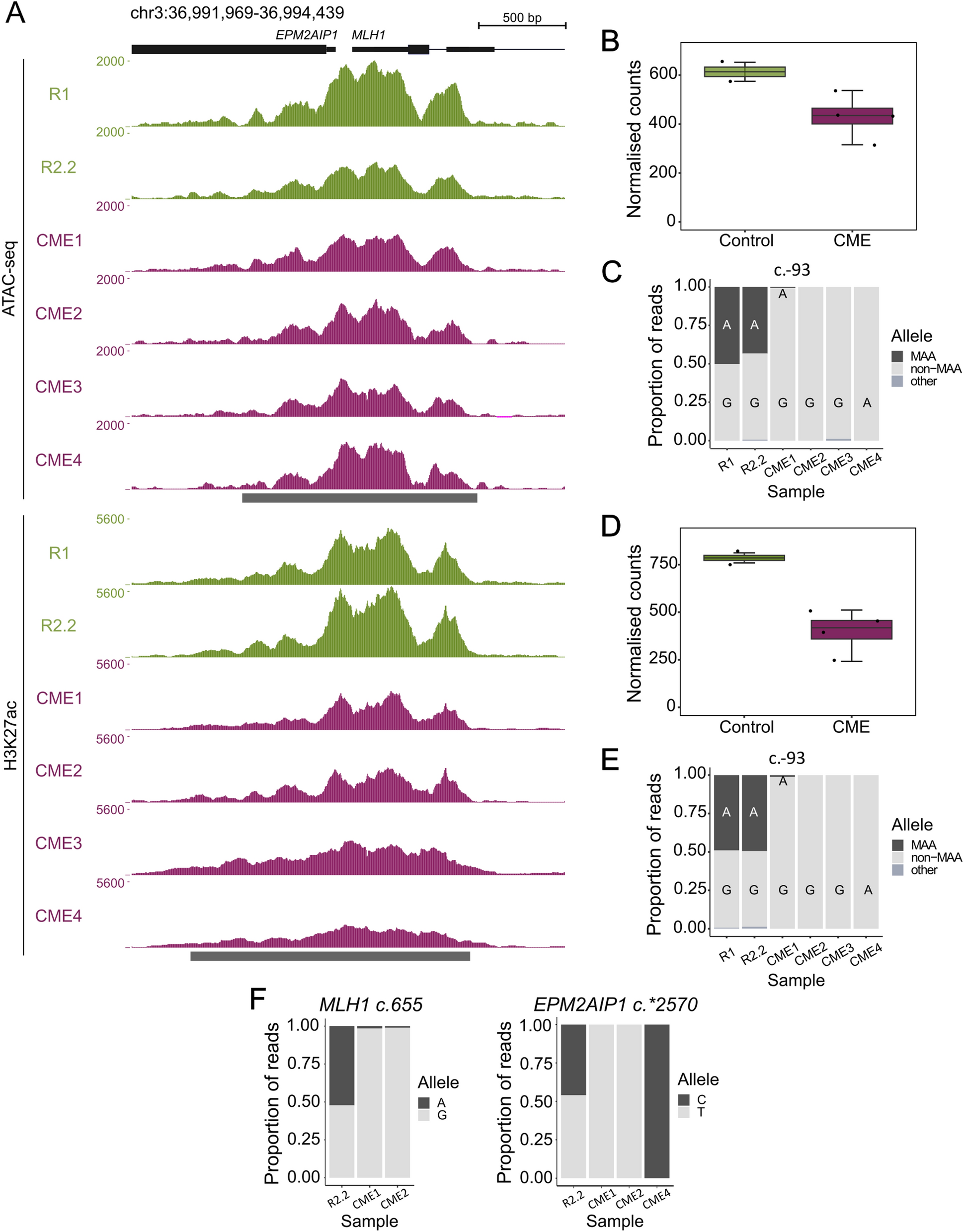 Altered chromatin landscape and 3D interactions associated with primary constitutional MLH1 epimutations