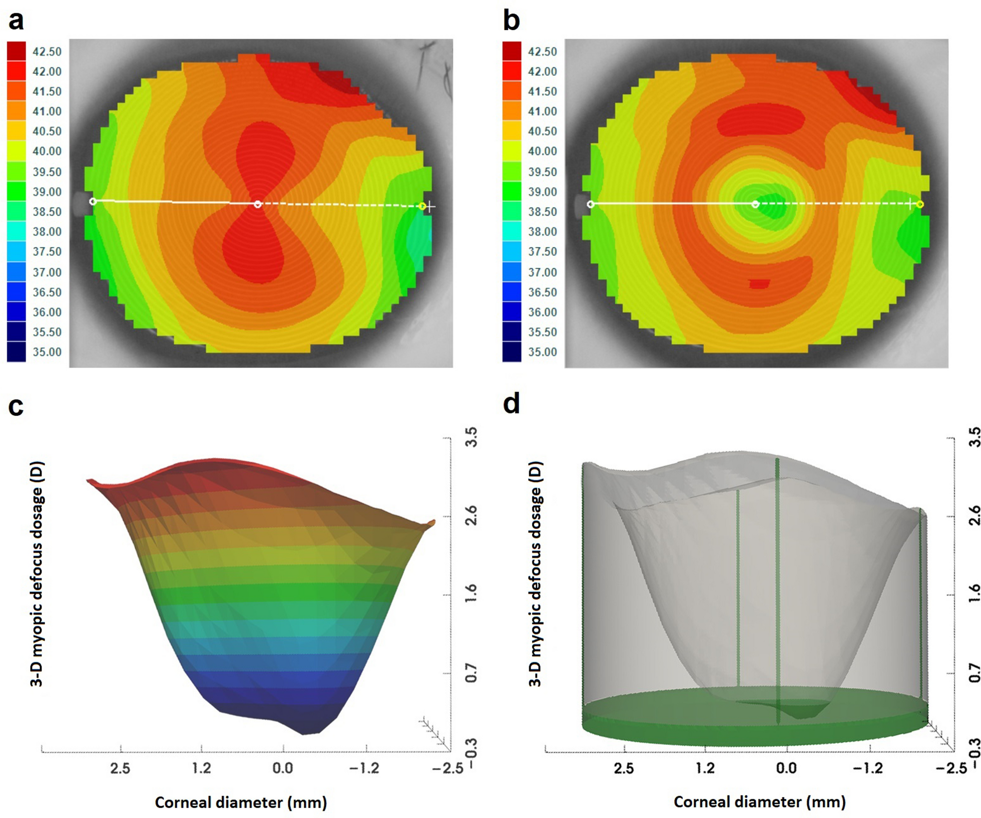 Association between axial elongation and corneal topography in children undergoing orthokeratology with different back optic zone diameters