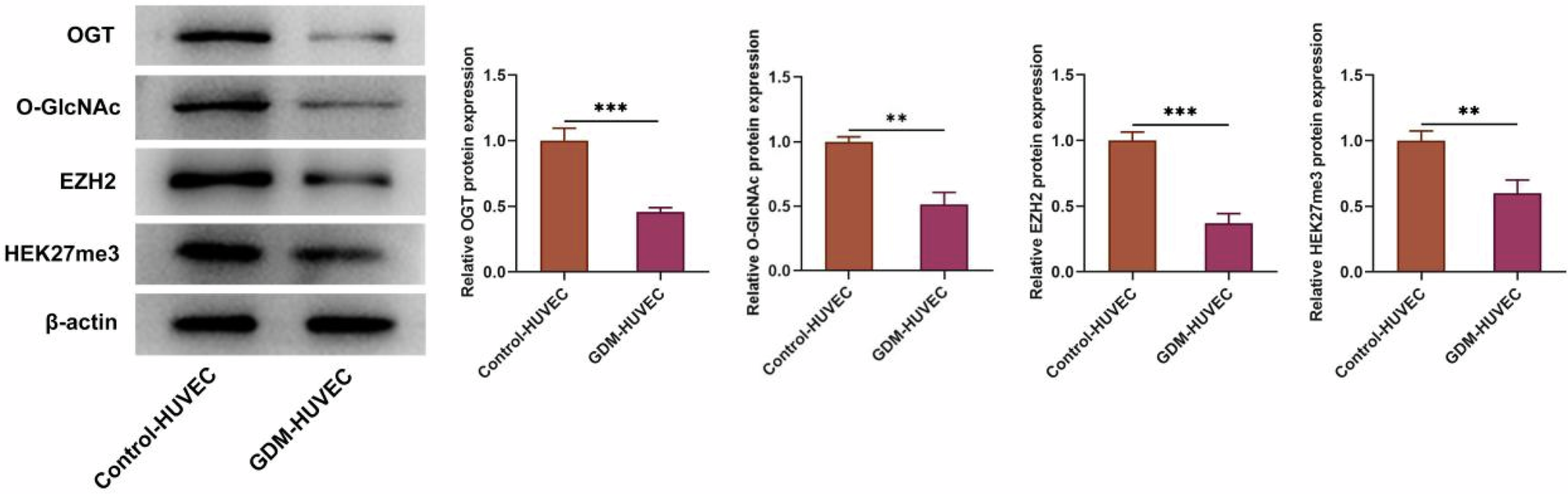 Upregulation of OGT-mediated EZH2 O-GlcNAcylation Promotes Human Umbilical Vein Endothelial Cell Proliferation, Invasion, Migration, and Tube Formation in Gestational Diabetes Mellitus