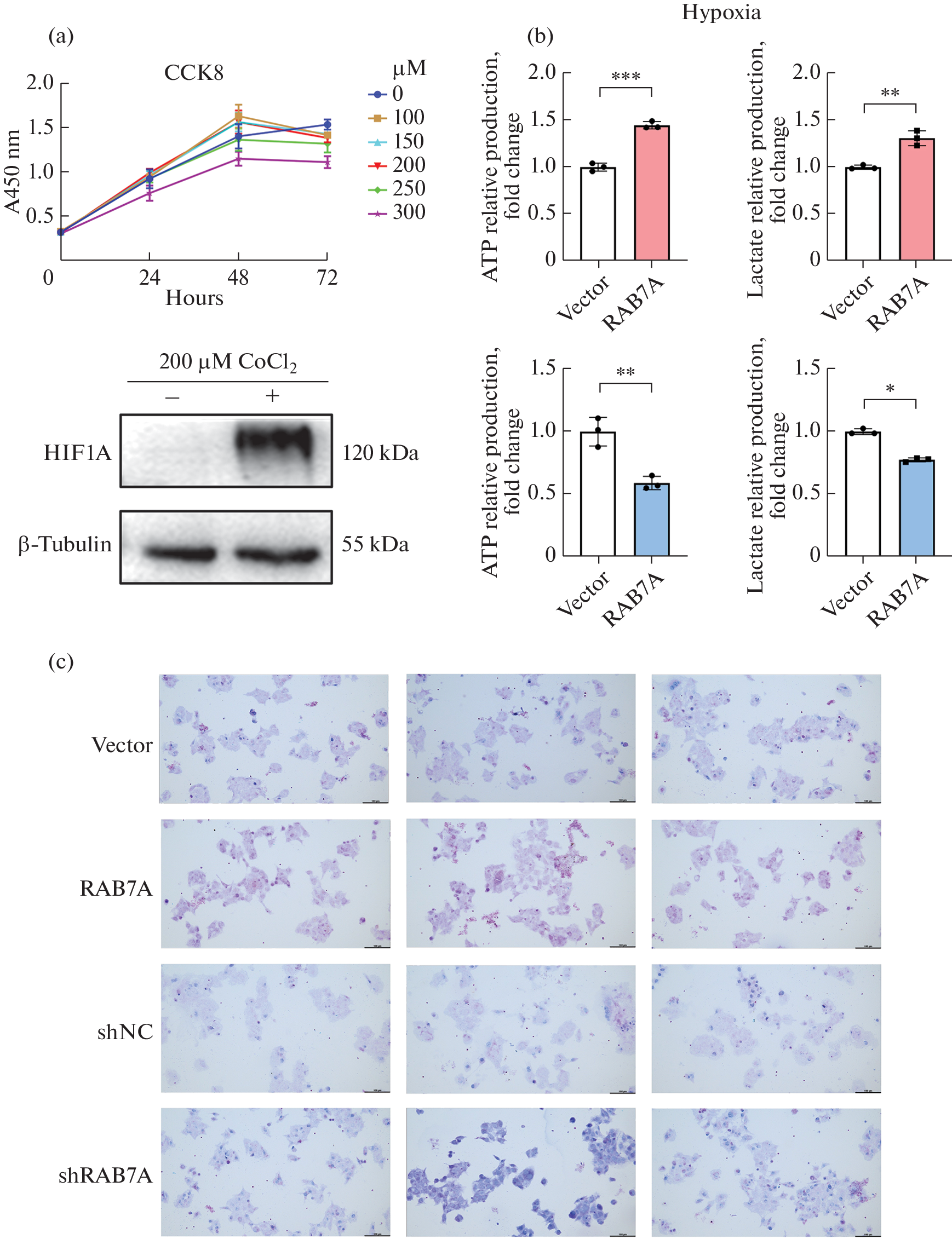 Ras-Related Protein Rab-7a Regulates Glucose Metabolism under Hypoxia by Interacting with Hypoxia-Inducible Factor 1-Alpha in HepG2 Cells