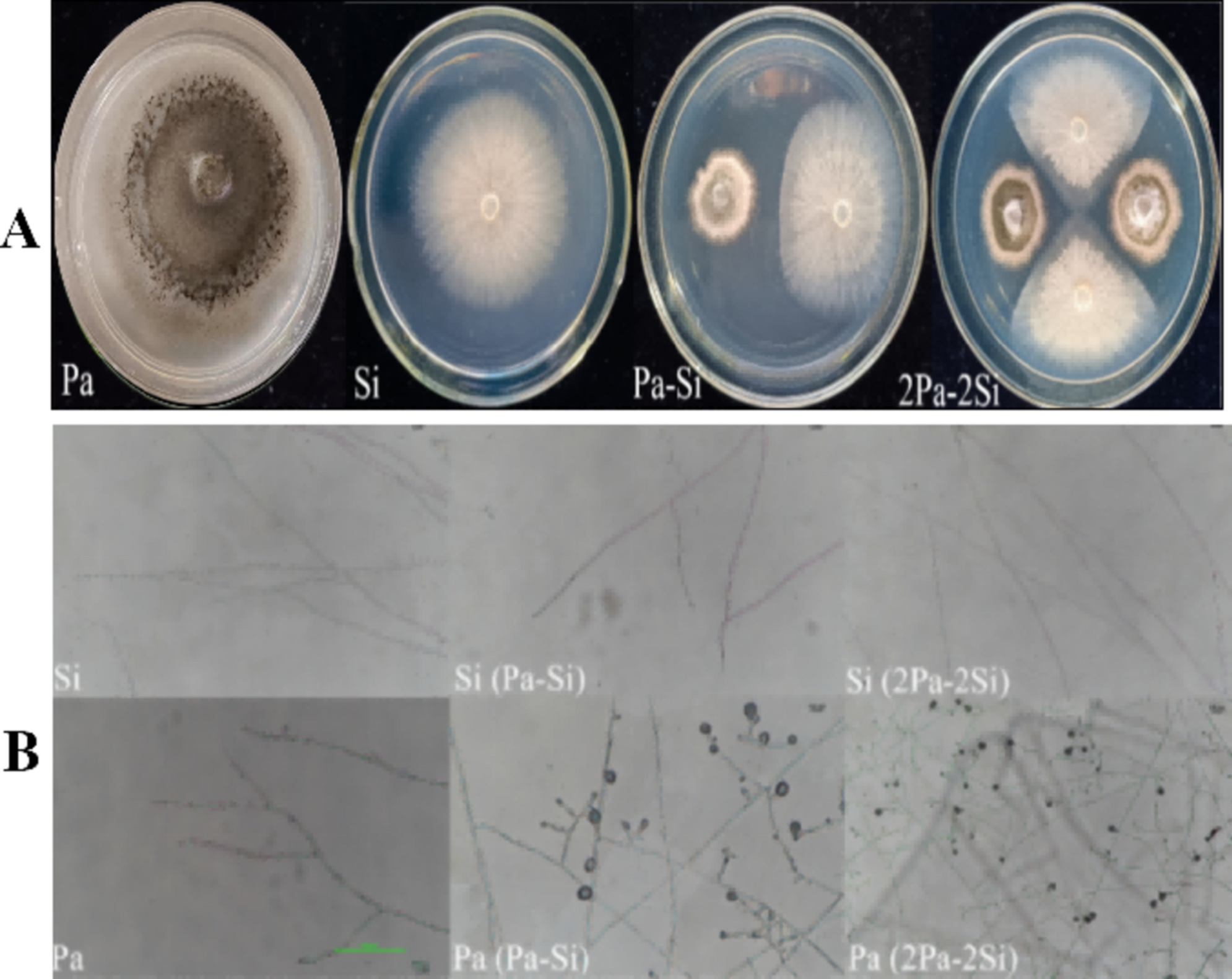 Colonization of Serendipita indica enhances resistance against Phoma arachidicola in Arachis hypogaea L