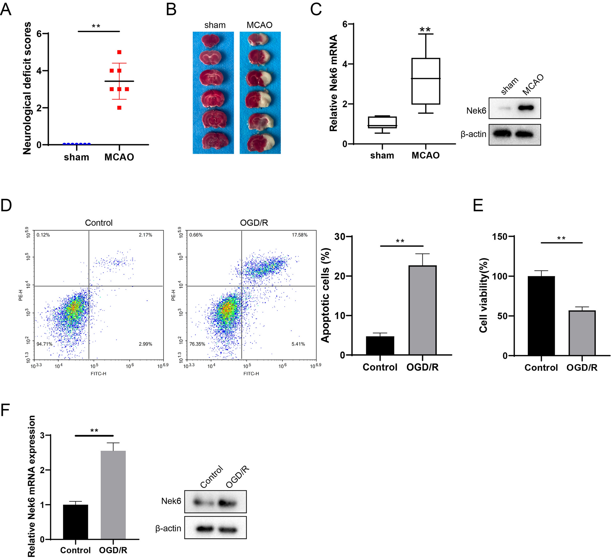 Nek6 regulates autophagy through the mTOR signaling pathway to alleviate cerebral ischemia–reperfusion injury
