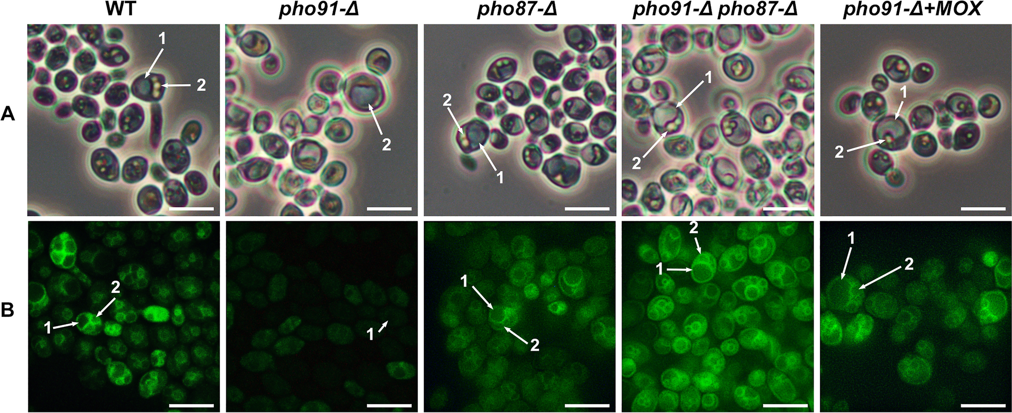 Inability of Ogataea parapolymorpha pho91-Δ mutant to produce active methanol oxidase can be compensated by inactivation of the PHO87 gene