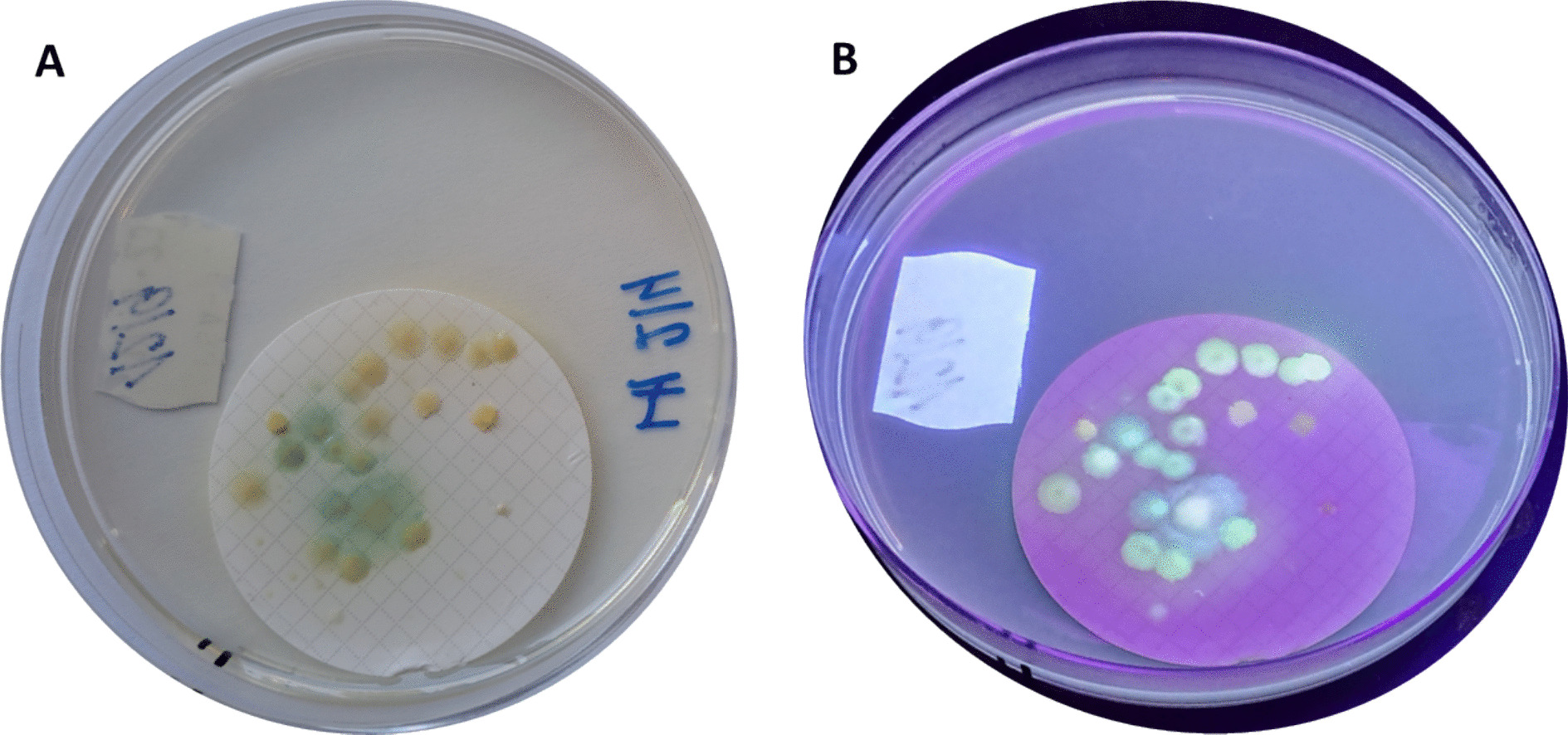 The occurrence of opportunistic pathogenic Pseudomonas species in bathing ponds