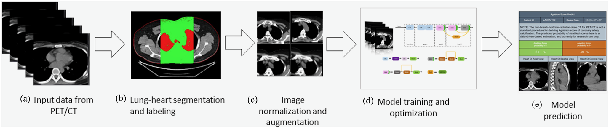 Application of deep learning in automated localization and interpretation of coronary artery calcification in oncological PET/CT scans