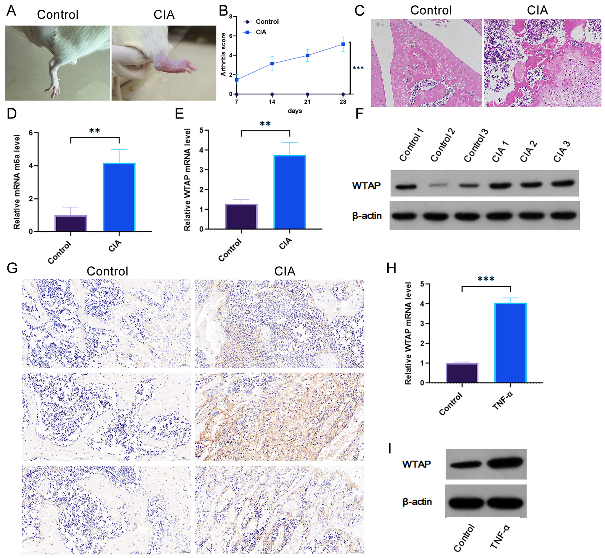 WTAP promotes fibroblast-like synoviocyte pyroptosis in Rheumatoid arthritis by upregulating N6-methyladenosine modification of NLRP3