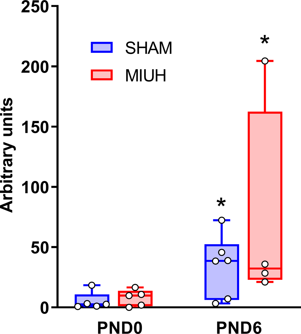 Enduring effects of acute prenatal ischemia in rat soleus muscle, and protective role of erythropoietin