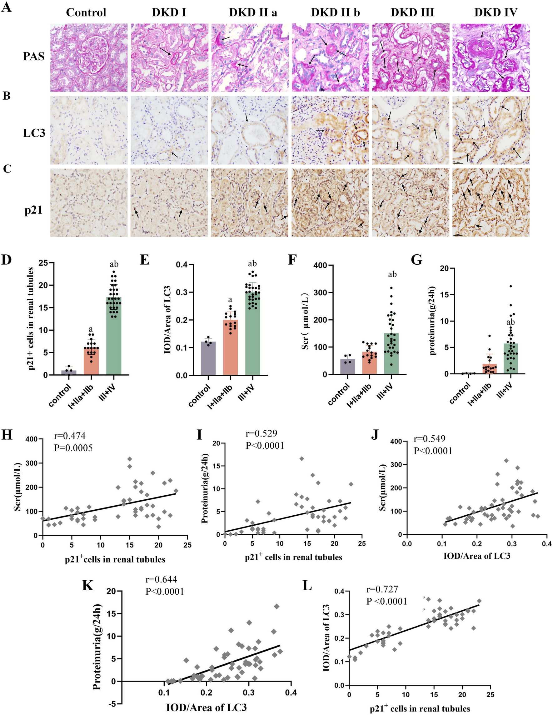 High glucose induces renal tubular epithelial cell senescence by inhibiting autophagic flux