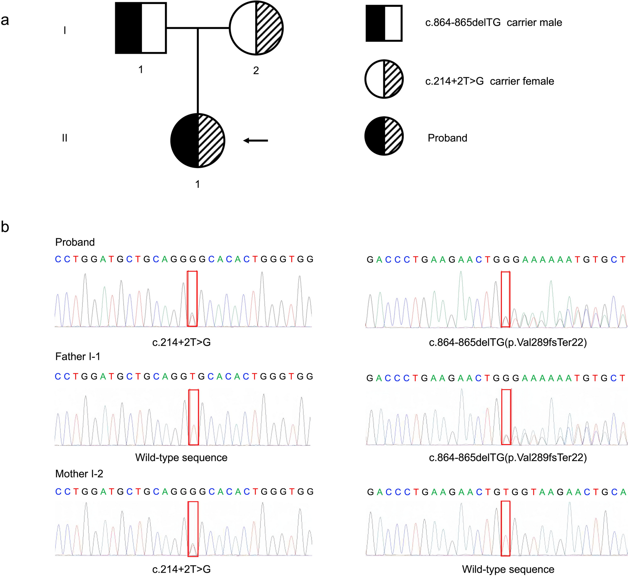 Title: Identification of a novel GRHPR mutation in primary hyperoxaluria type 2 and establishment of patient-derived iPSC line
