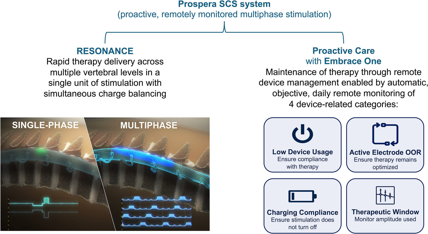 A Review of the Prospera Spinal Cord Stimulation System with Multiphase Stimulation and Proactive Care