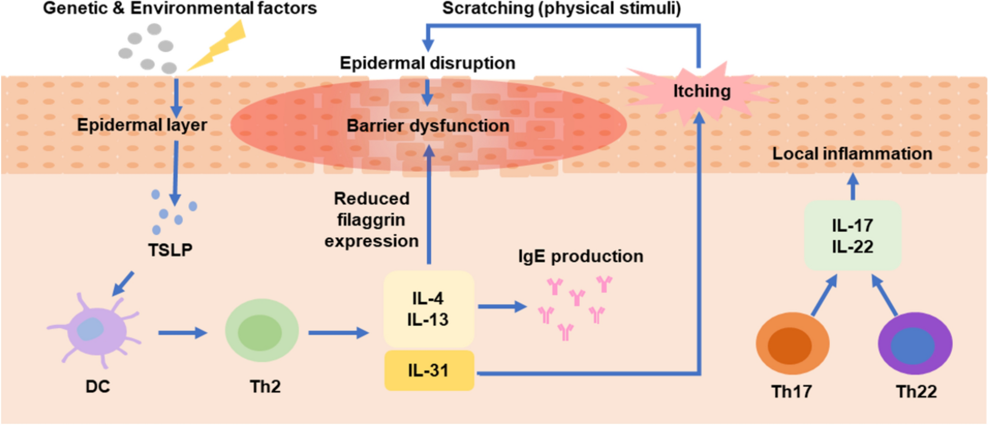 Exosomes and Exosome-Mimetics for Atopic Dermatitis Therapy