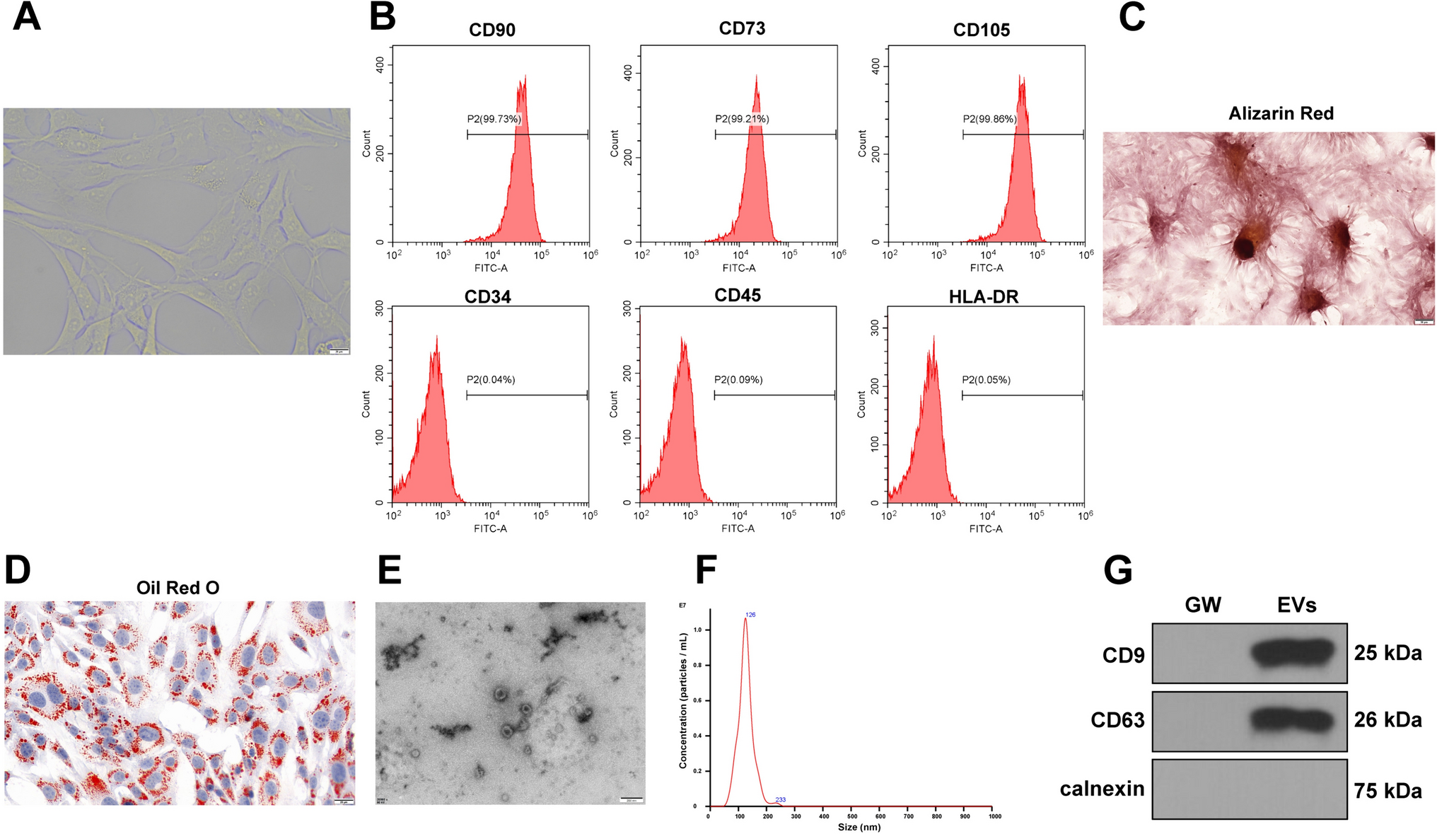Mesenchymal Stem Cell-Derived Extracellular Vesicles Carrying Circ-Tulp4 Attenuate Diabetes Mellitus with Nonalcoholic Fatty Liver Disease by Inhibiting Cell Pyroptosis through the HNRNPC/ABHD6 Axis