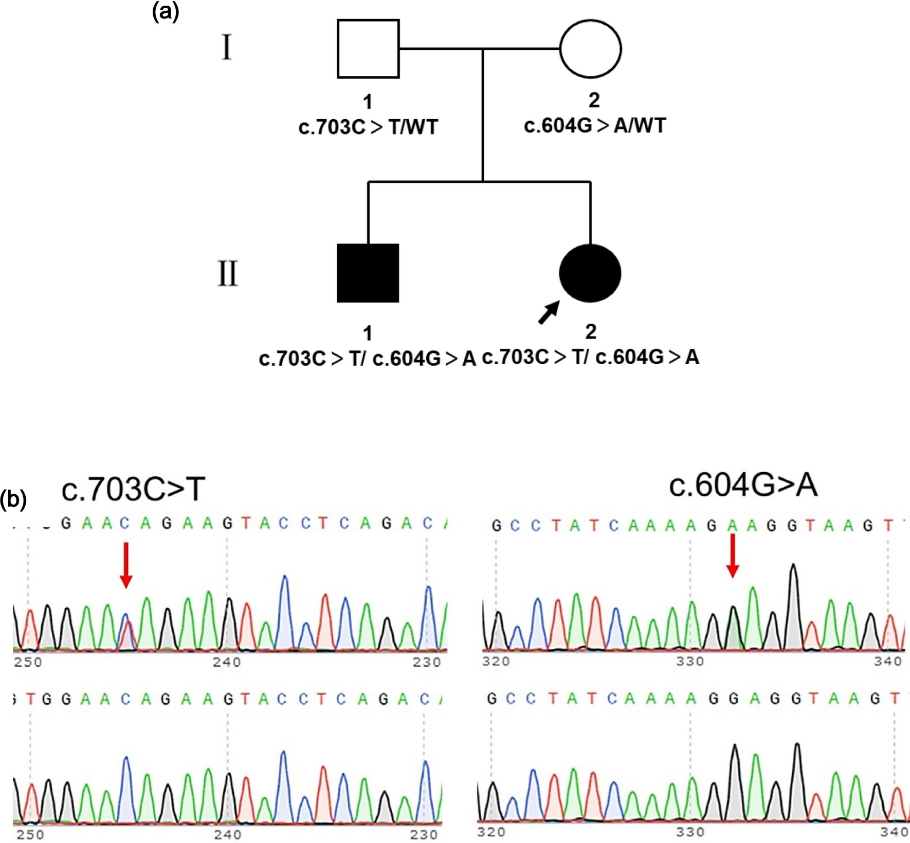 Novel compound heterozygous mutations in the LARS2 gene in a Chinese family with hearing loss
