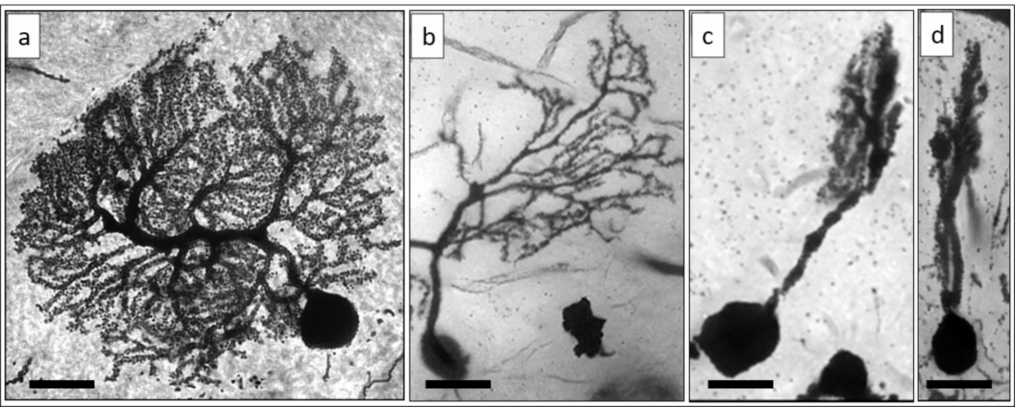 Dendritic pathology and overexpression of MAP2 in Purkinje cells from mice inoculated with rabies virus