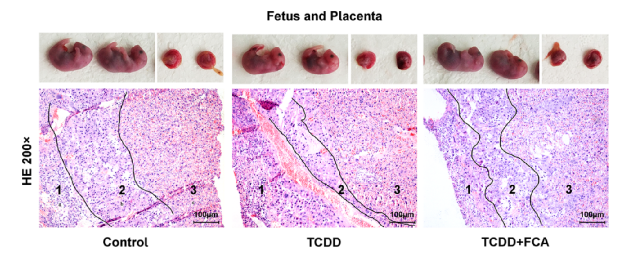 Effect of 2,3,7,8-tetrachlorodibenzo-p-dioxin (TCDD) on the immune system maternal-fetal interface during palatal development