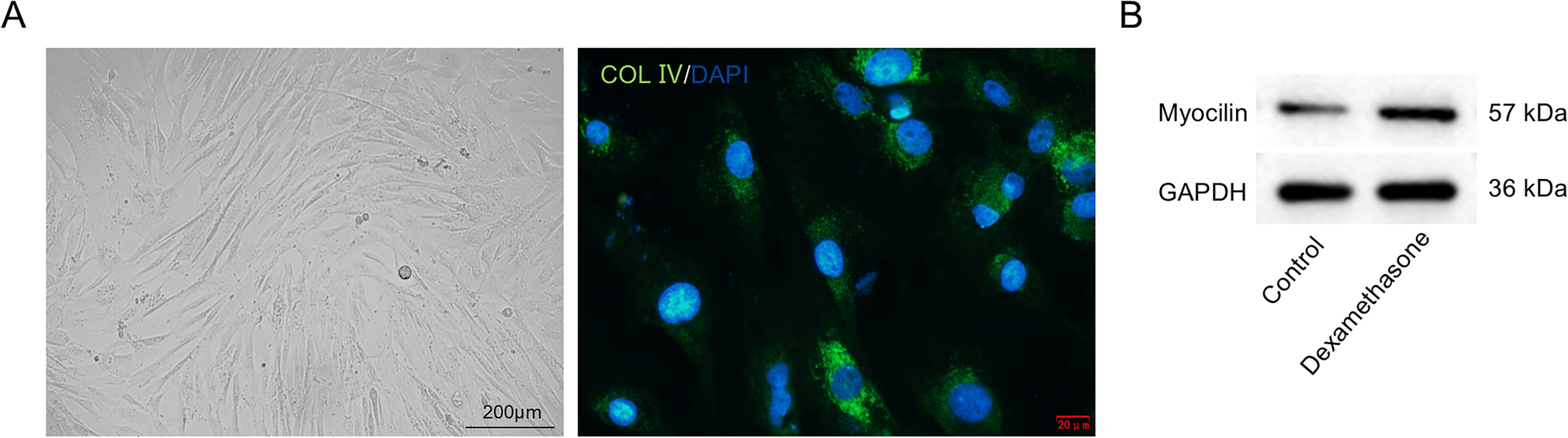 Silencing miR-126-5p protects trabecular meshwork cells against chronic oxidative injury by upregulating HSPB8 to activate PI3K/AKT pathway