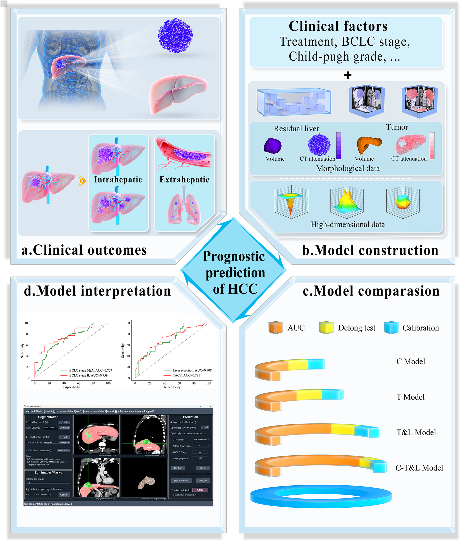 3D synergistic tumor-liver analysis further improves the efficacy prediction in hepatocellular carcinoma: a multi-center study