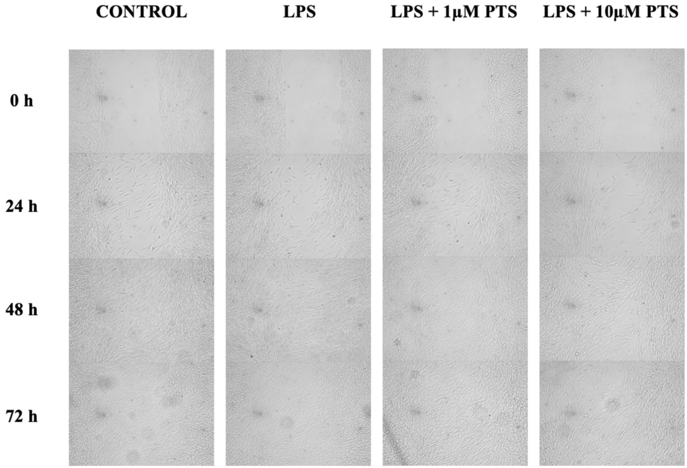 Evaluation of the anti-inflammatory, antioxidant and wound healing effects of pterostilbene in human gingival fibroblasts in vitro