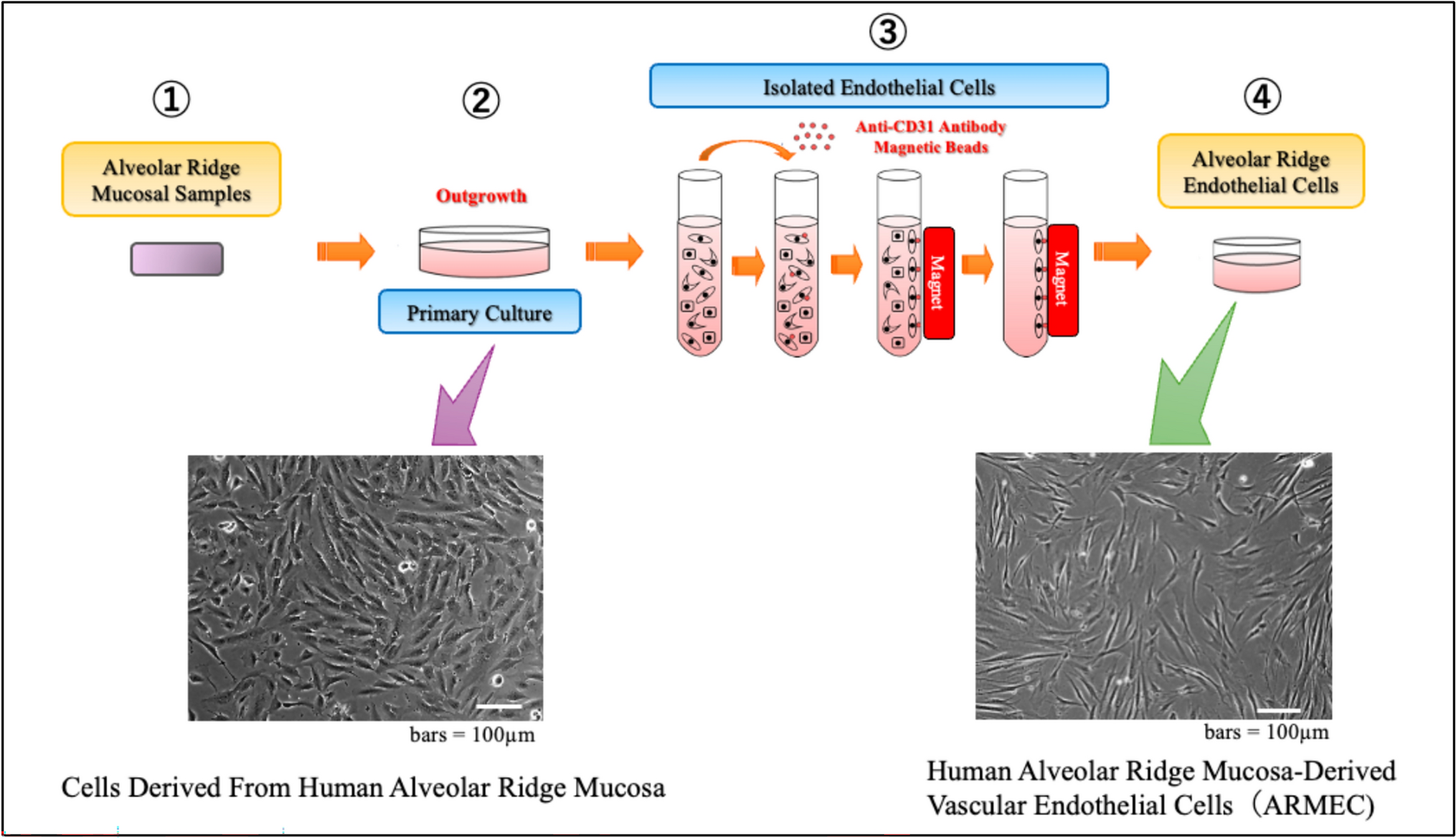 Immunogenic effects of enamel matrix derivative on human alveolar ridge mucosa-derived vascular endothelial cells under lipopolysaccharide stimulation