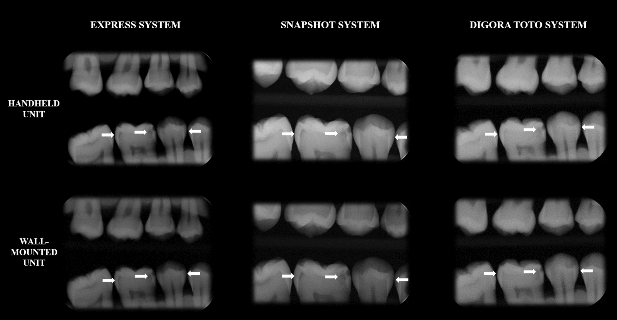 Influence of a handheld X-ray unit in the diagnosis of proximal caries lesions using different digital systems