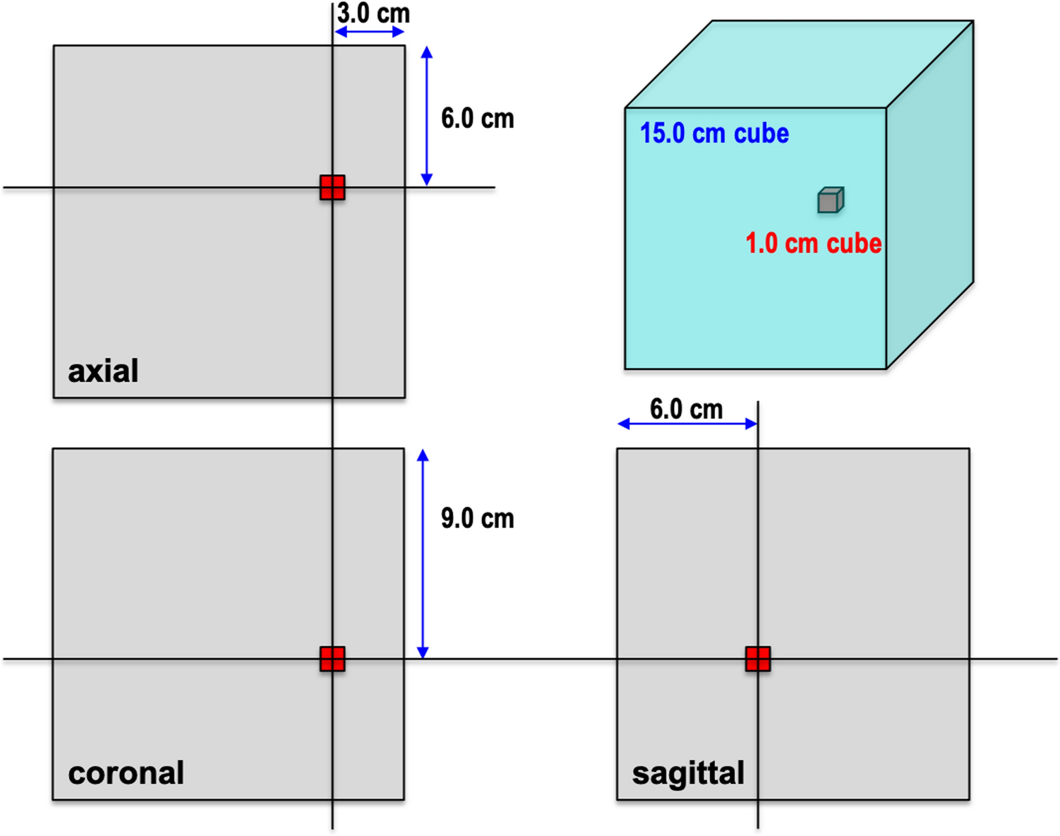 Effect of metallic materials on magnetic resonance image uniformity: a quantitative experimental study