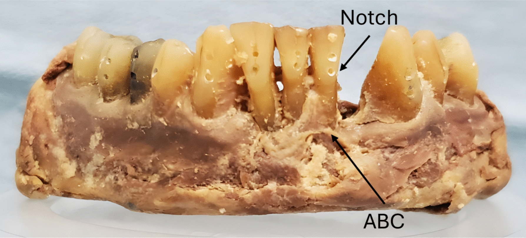 Accuracy of intraoral ultrasound to evaluate alveolar bone level: an ex vivo study in human cadavers