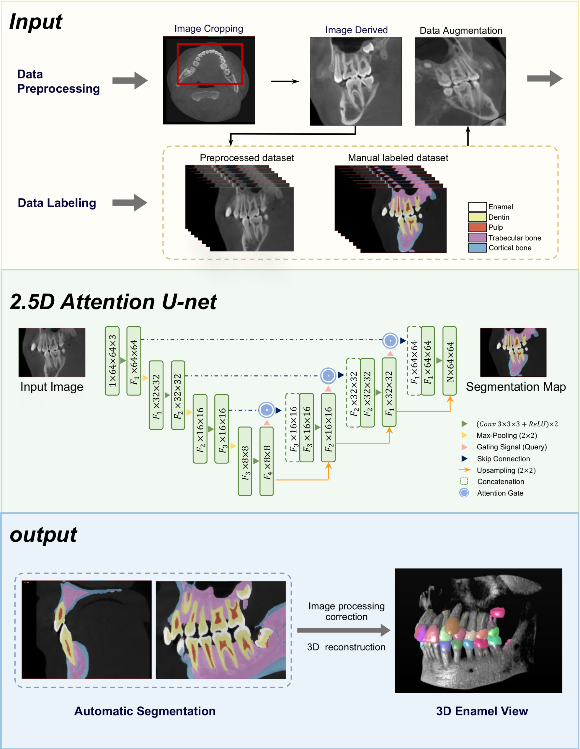 Clinically oriented automatic three-dimensional enamel segmentation via deep learning