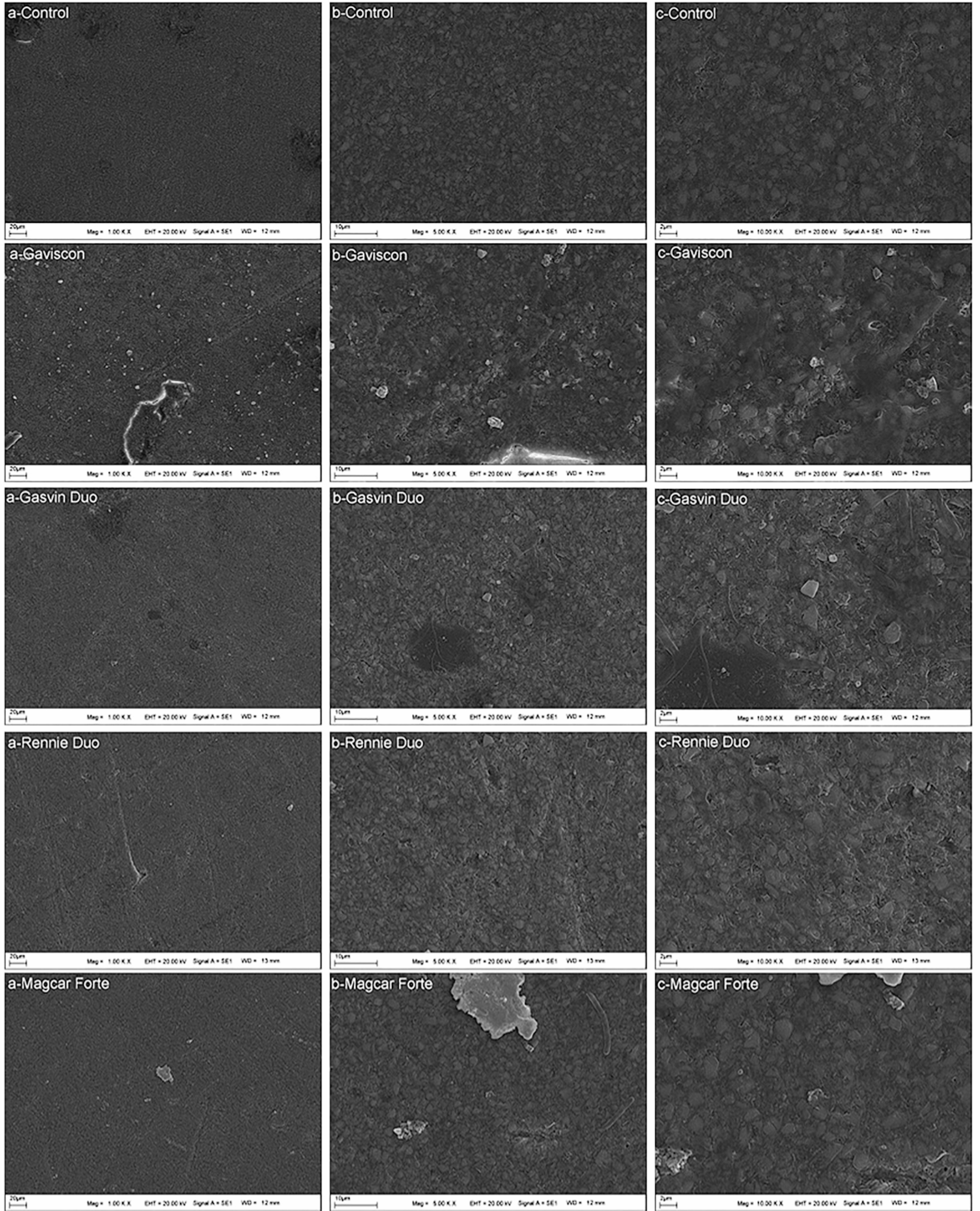 Effect of antacid gastric syrups on surface properties of dental restorative materials: an in vitro analysis of roughness and microhardness