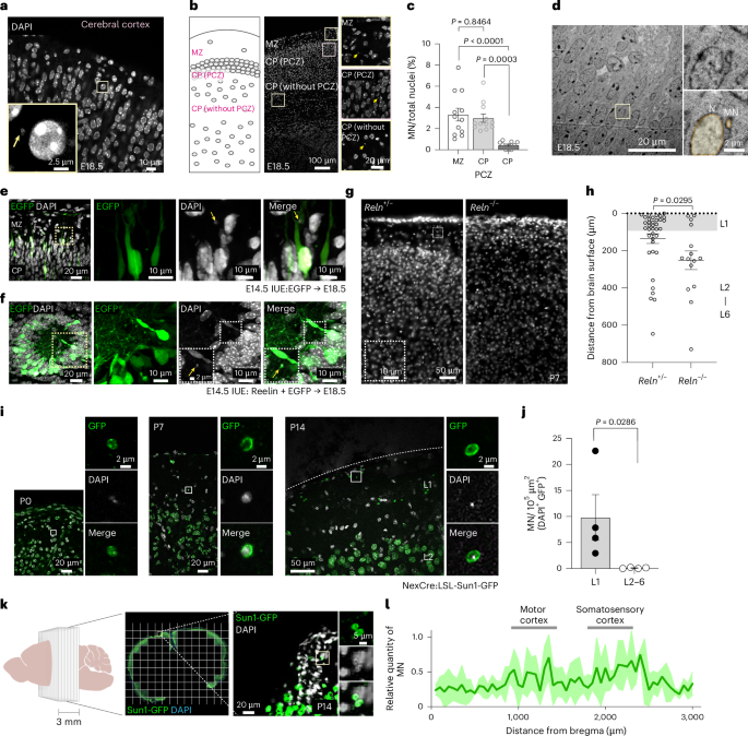 Propagation of neuronal micronuclei regulates microglial characteristics