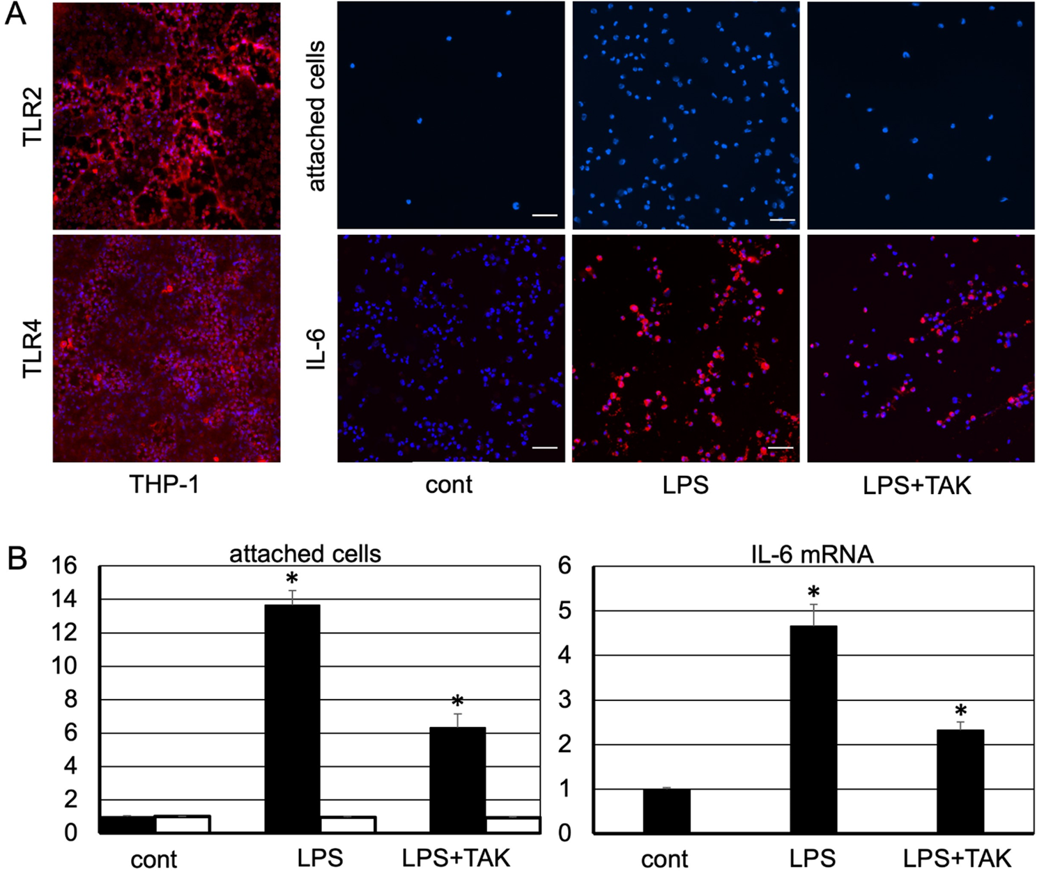 Exacerbation of diabetes due to F. Nucleatum LPS-induced SGLT2 overexpression in the renal proximal tubular epithelial cells