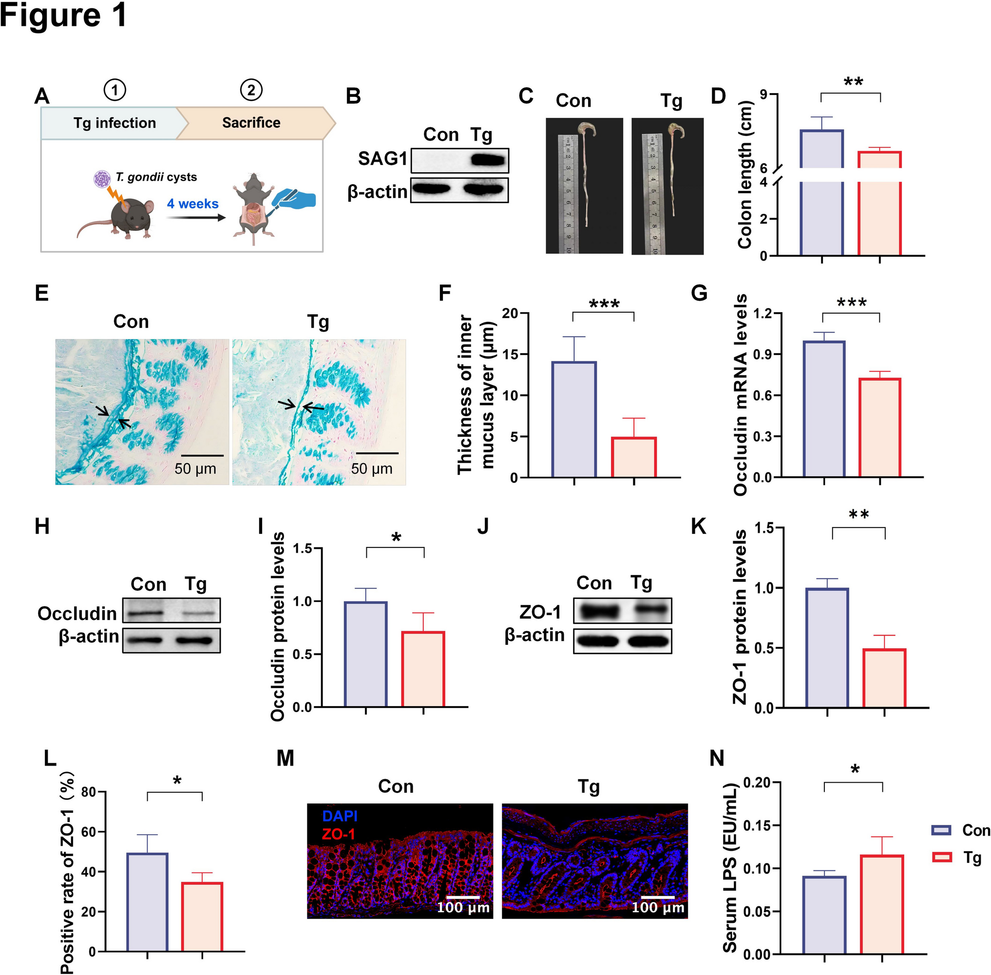 Cellular Senescence Contributes to Colonic Barrier Integrity Impairment Induced by Toxoplasma gondii Infection