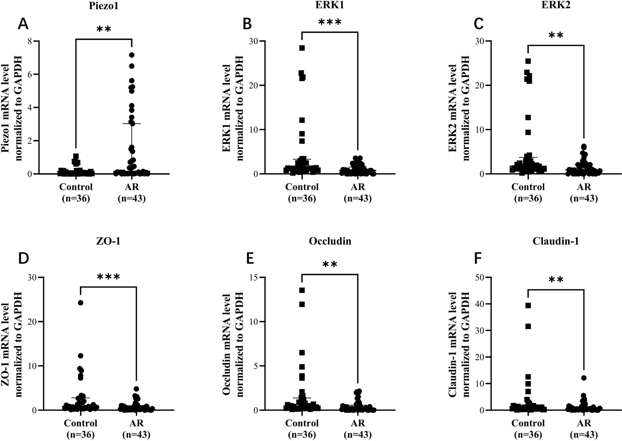Piezo1-Induced Nasal Epithelial Barrier Dysfunction in Allergic Rhinitis