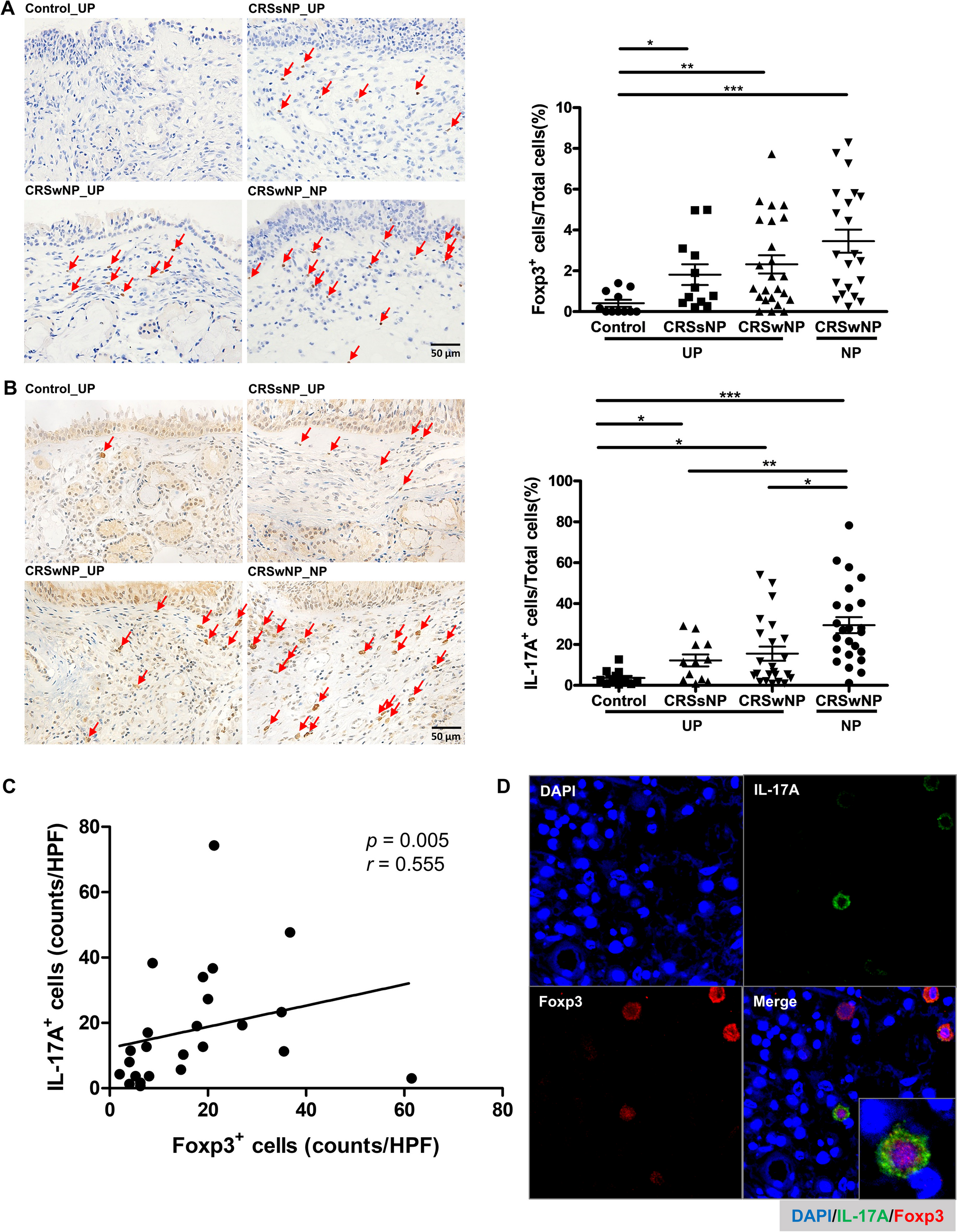 Elevated IL-17A-Secreting Regulatory T Cells in Sinonasal Tissues of Chronic Rhinosinusitis with Nasal Polyps
