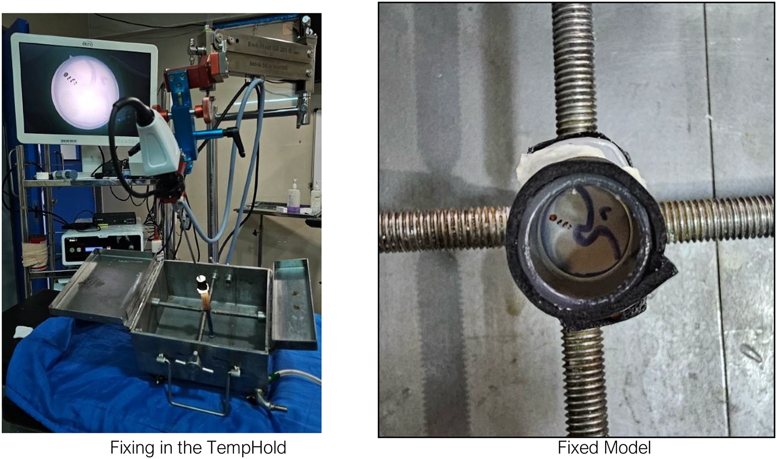 Elevating Expertise: A Comprehensive Guide to Two Handed Endoscopic Myringotomy and Tympanostomy Tube Placement Training