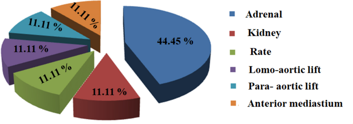 The Advancing Frontier: Robotic-Assisted Laparoscopy in Pediatric Tumor Management