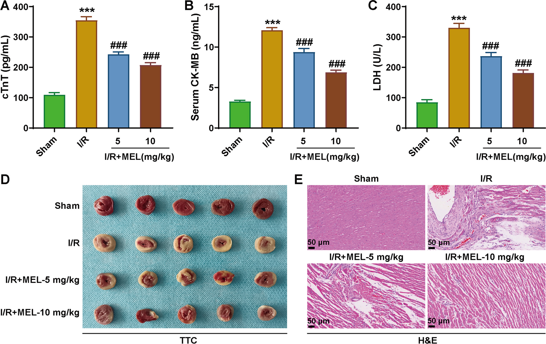 Melatonin inhibits ferroptosis through the ATF3/GPX4 signaling pathway to relieve myocardial ischemia–reperfusion injury in rats