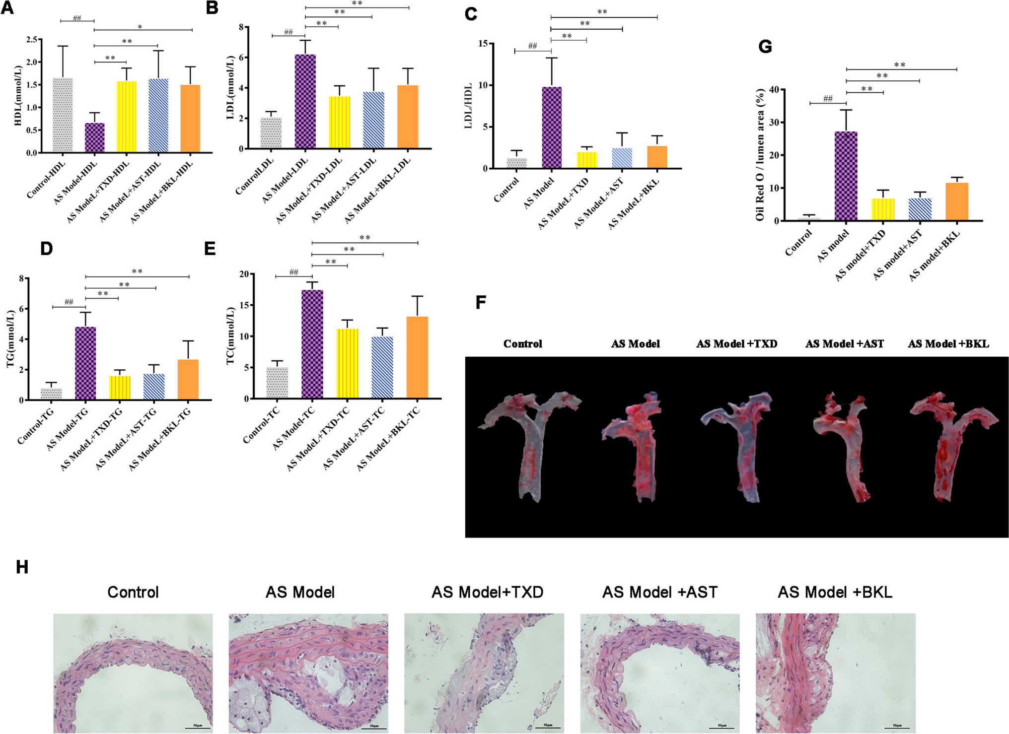 Tianxiangdan suppresses foam cell formation by enhancing lipophagy and reduces the progression of atherosclerosis