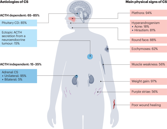 Cushing syndrome