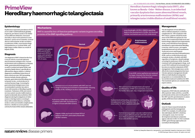 Hereditary haemorrhagic telangiectasia