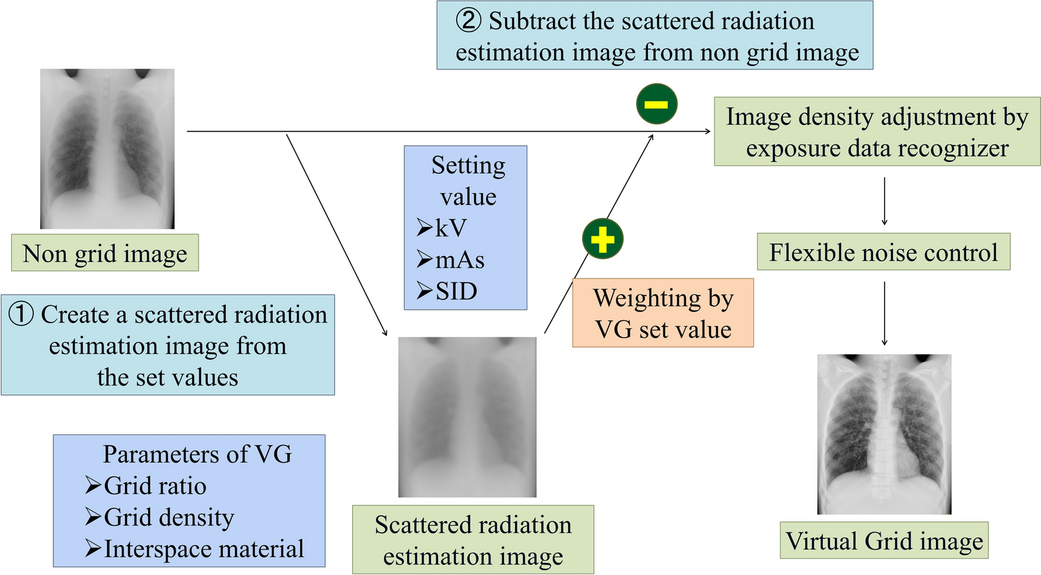 Development of an image quality evaluation system for bedside chest X-ray images using scatter correction processing