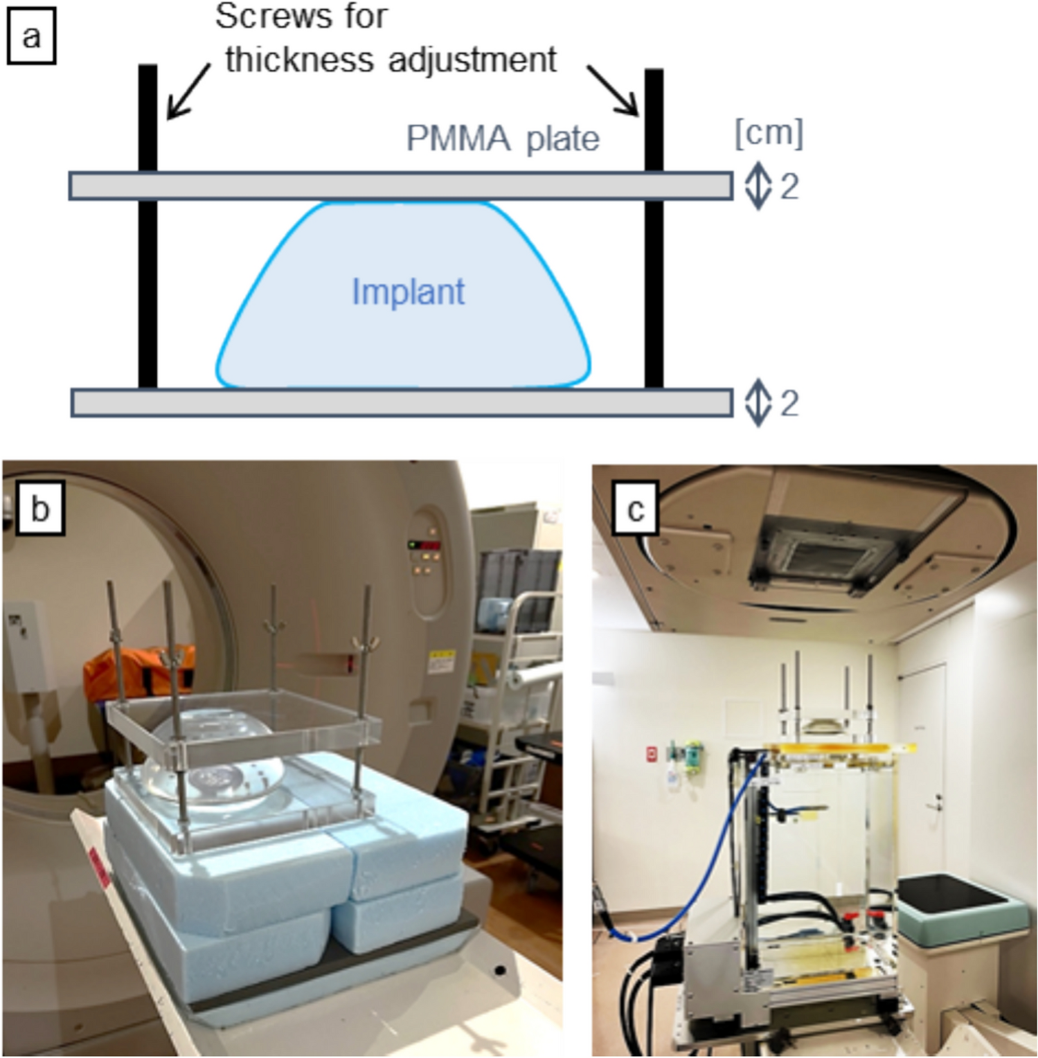 Evaluation of stopping power ratio of artificial breast implants for carbon-ion radiotherapy