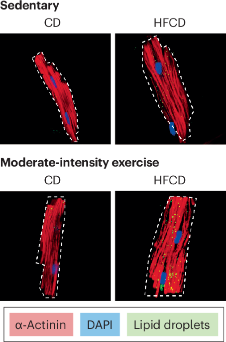 Exercise exacerbates cardiac damage from high-fat, high-calorie feeding in mice