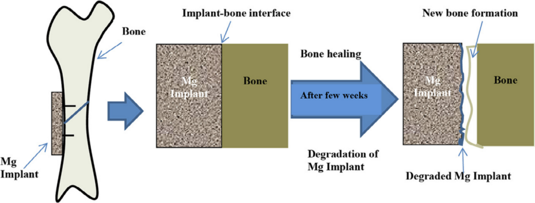 A Review on Magnesium Matrix Composites for Biomedical Applications: Materials, Fabrication Techniques, Coatings, and Applications