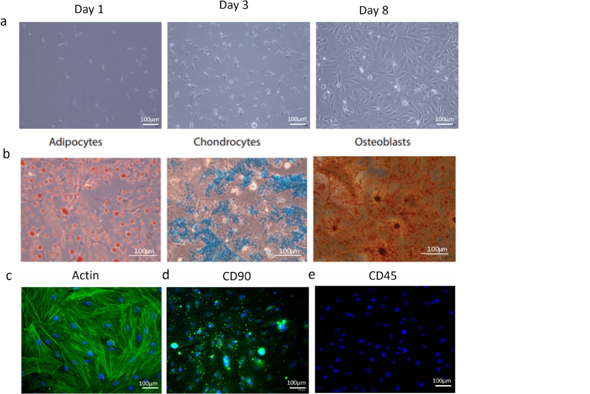 Wound Healing Effect of PRP-Induced MSC Secretome Under High Glucose Conditions: An In Vitro Study