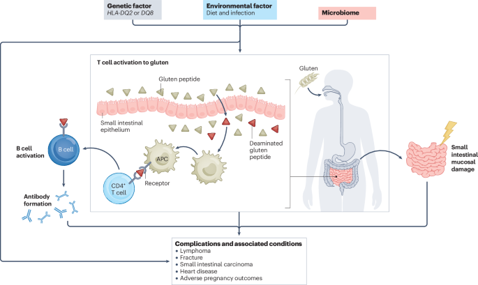 Coeliac disease: complications and comorbidities