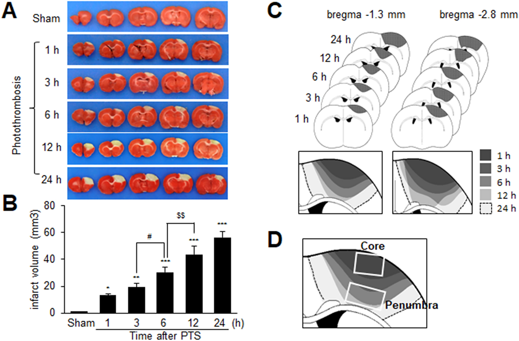 Platelet-derived HMGB1 induces NETosis, exacerbating brain damage in the photothrombotic stroke model