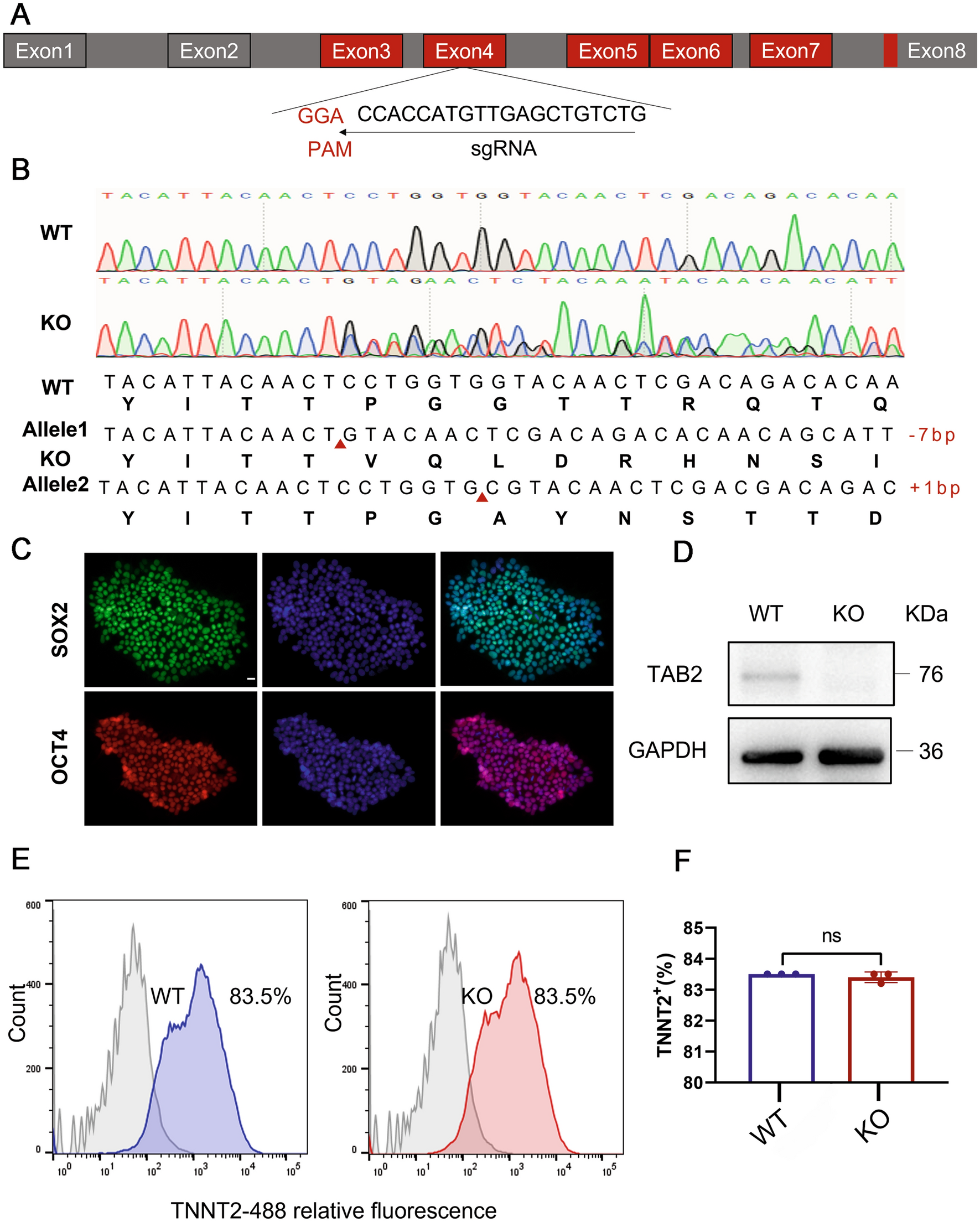 TAB2 deficiency induces dilated cardiomyopathy by promoting mitochondrial calcium overload in human iPSC-derived cardiomyocytes