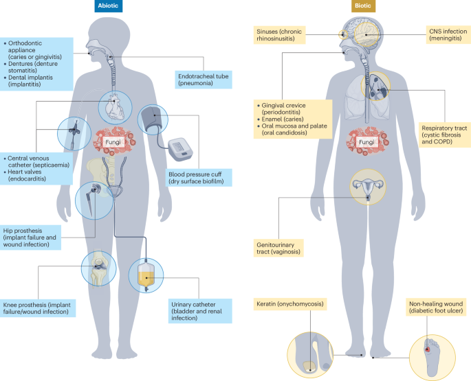 Fungal biofilms in human health and disease